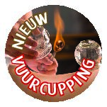 VuurCupping. De Afslank Studio